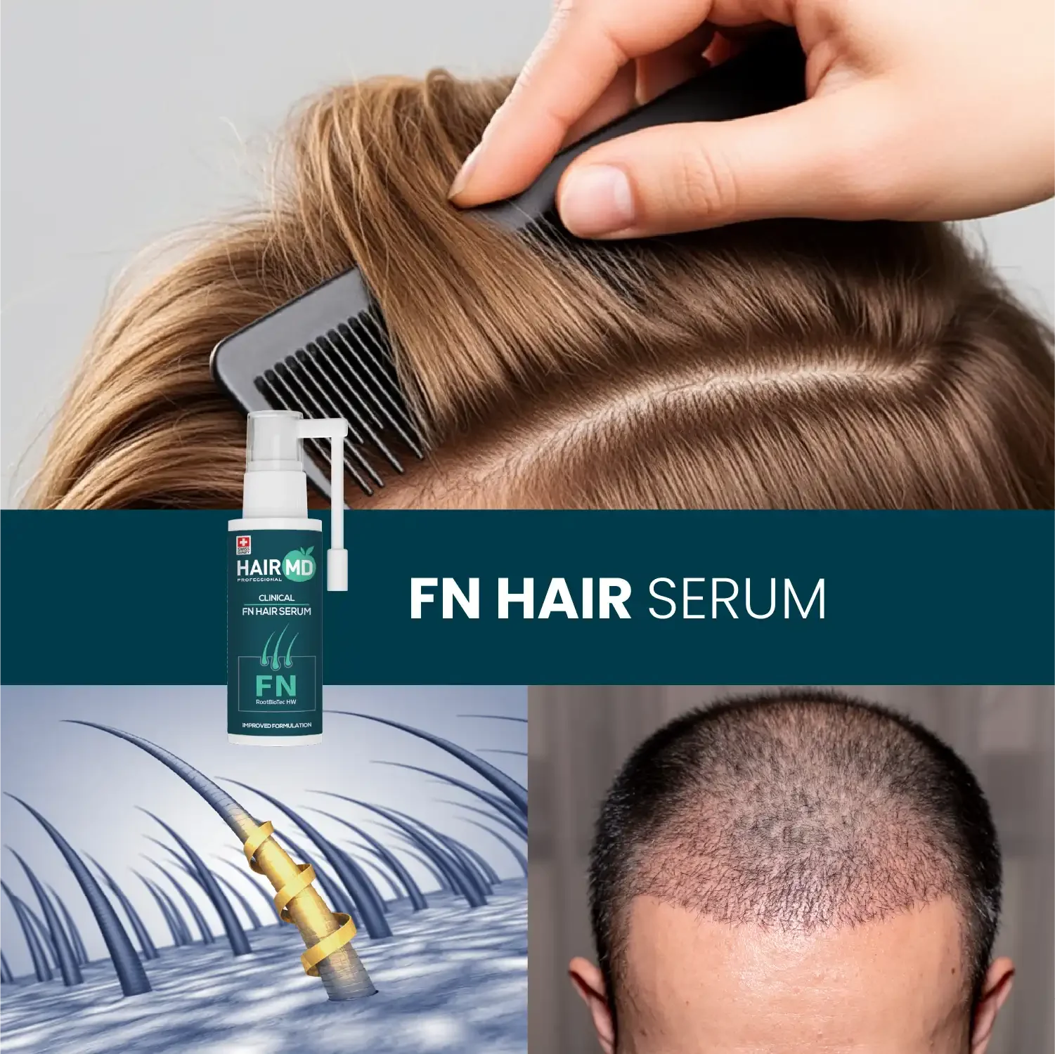 HairMD Klinik FN Saç Onarıcı Serum 60 ml - HAİR MEDİCAL SHOP 