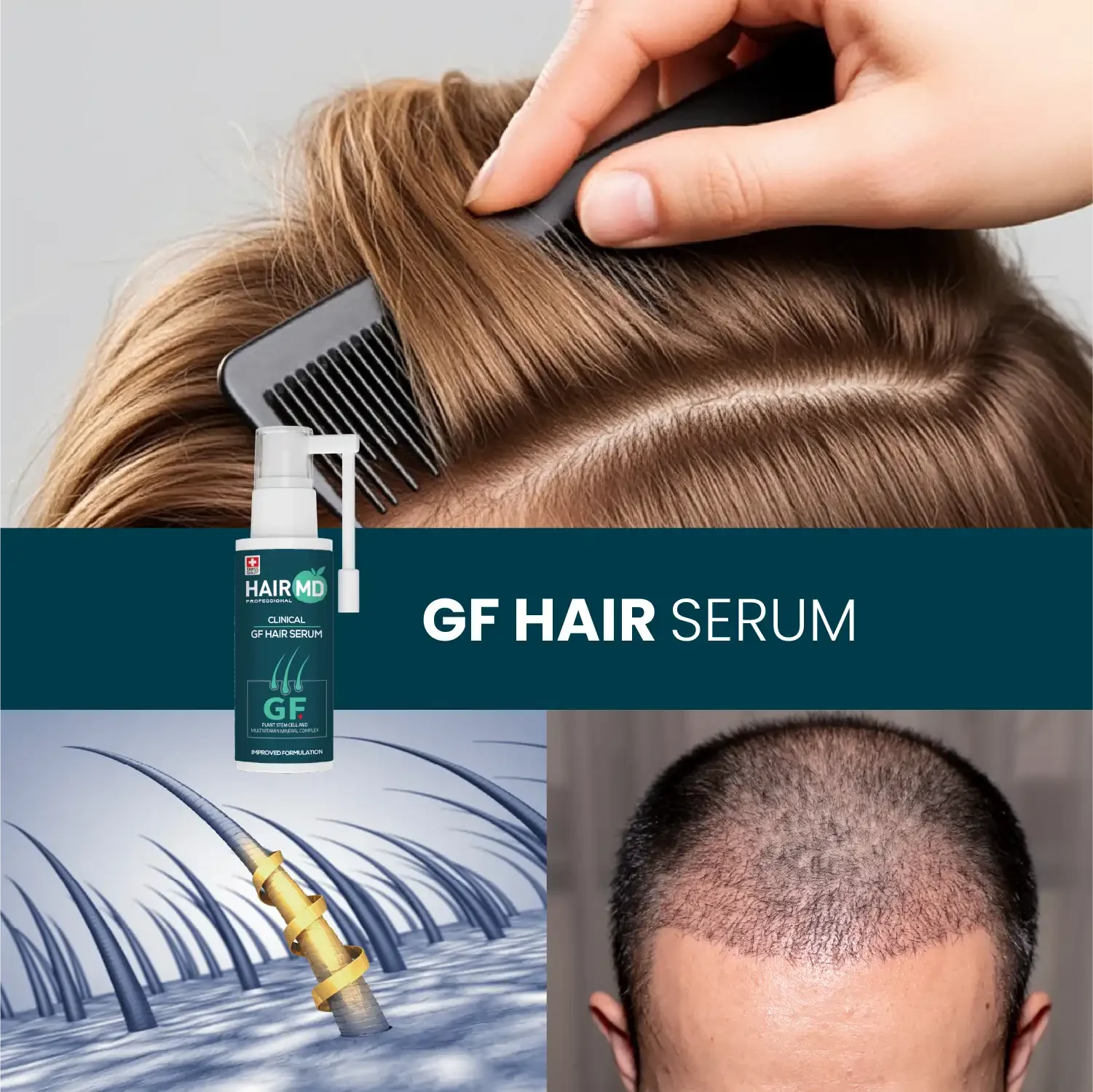HairMD Klinik GF+ Saç Onarıcı Serum 60 ml - HAİR MEDİCAL SHOP 