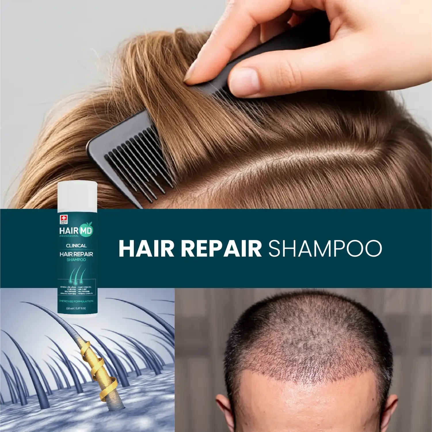 HairMD Klinik Saç Onarım Şampuanı 150 ml - HAİR MEDİCAL SHOP 