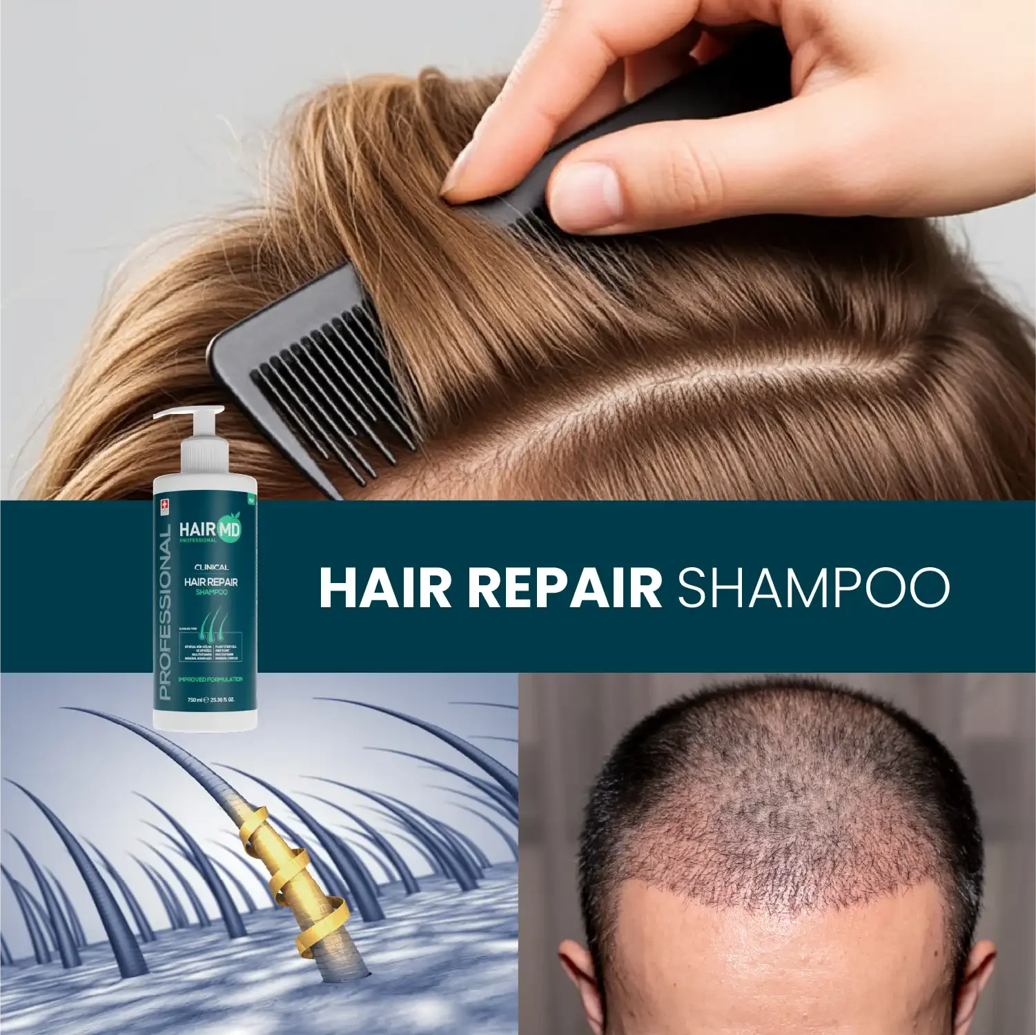 HairMD Klinik Saç Onarım Şampuanı 750 ml - HAİR MEDİCAL SHOP 