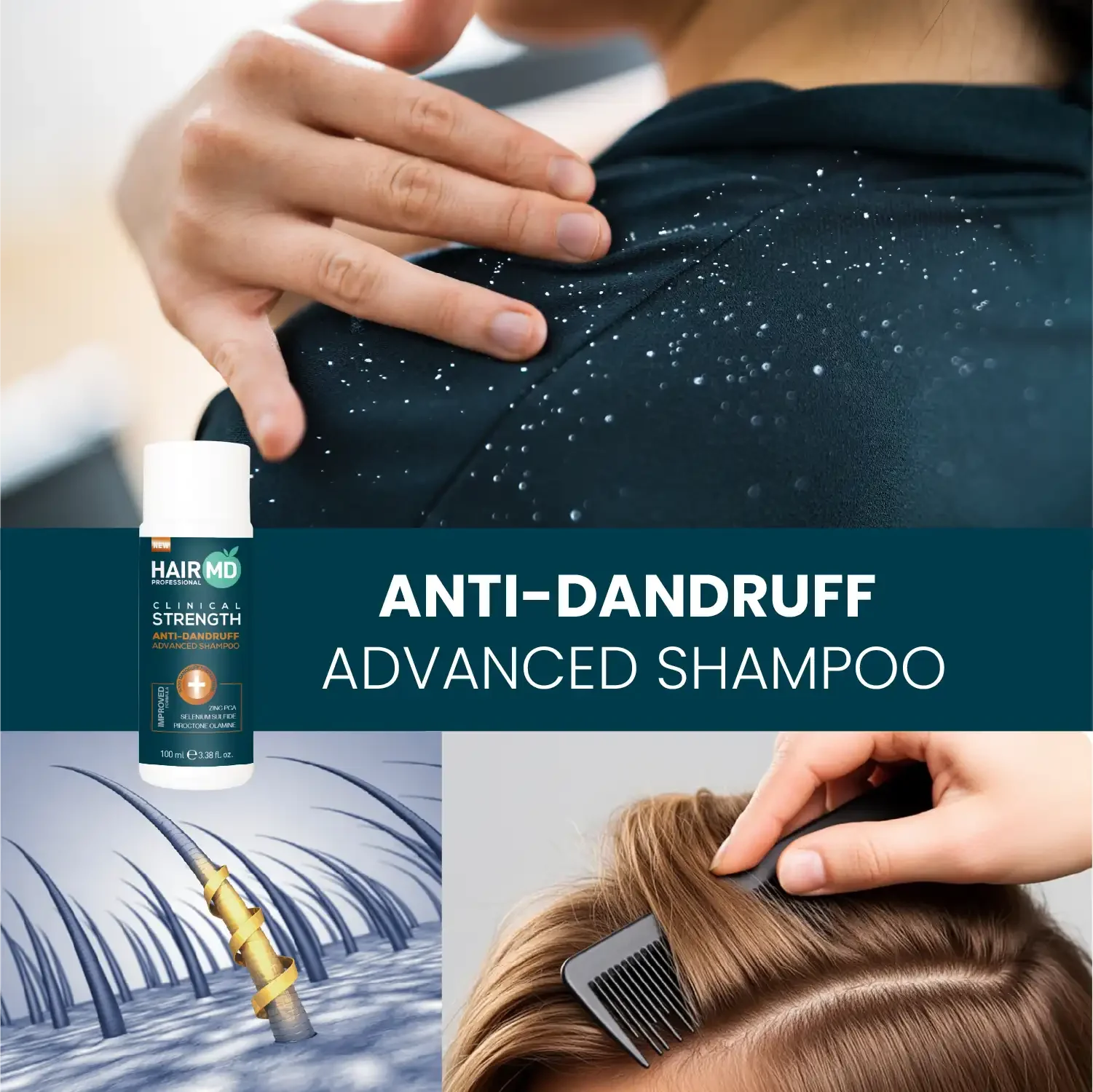 HairMD Klinik Kepek Önleyici Gelişmiş Şampuan 100 ml Anti Dandruff - HAİR MEDİCAL SHOP 