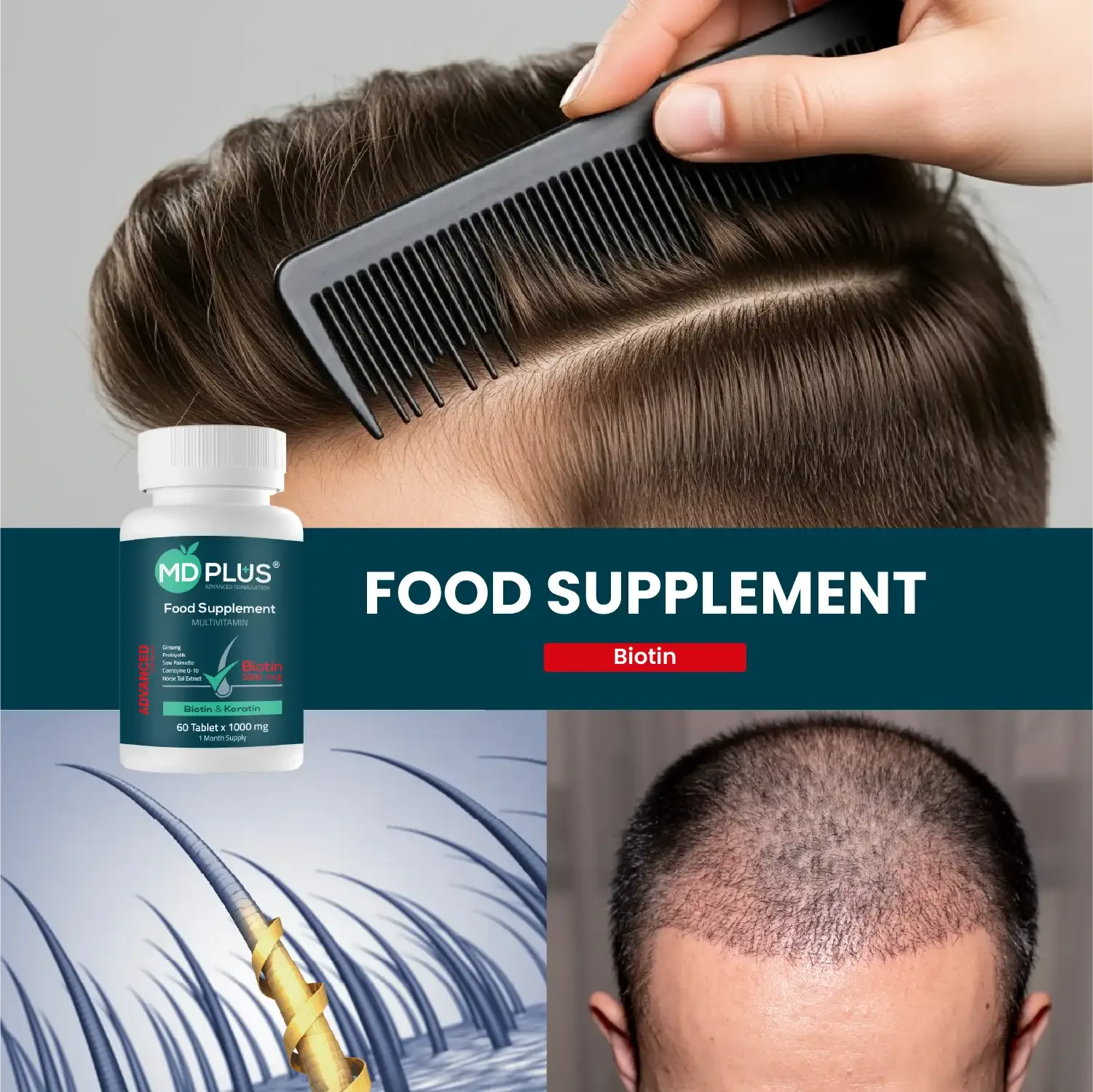 HAİRMD Plus Advanced Hair Biotin 5000 mcg 60 Tablet - HAİR MEDİCAL SHOP 