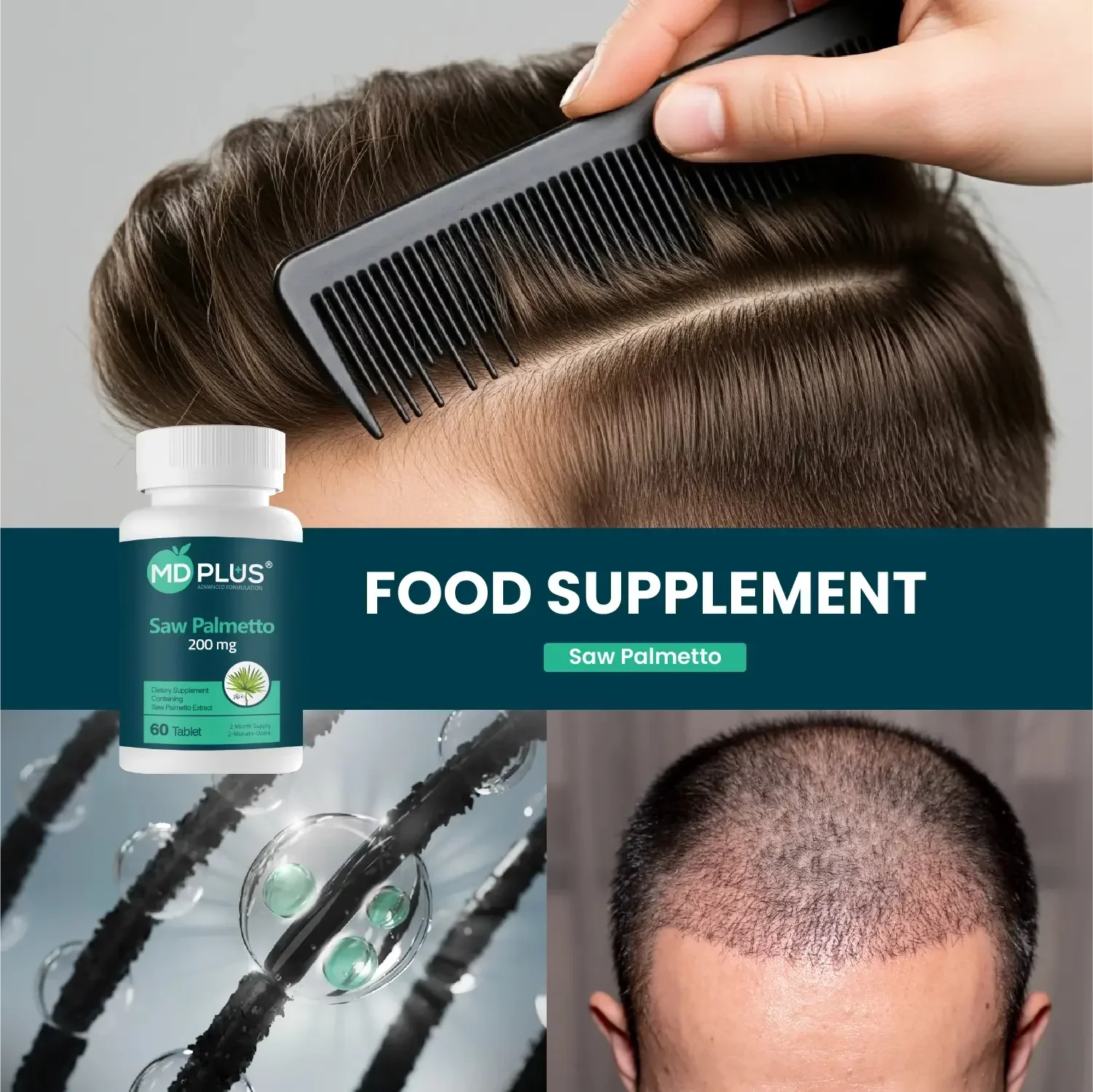 HAİRMD Plus Advanced Hair Saw Palmetto 200 mg 60 Tablet - HAİR MEDİCAL SHOP 
